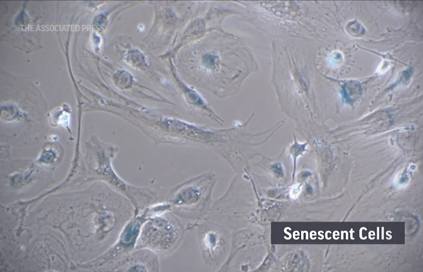 ซอมบี้เซลล์และเหตุแห่งความชรา